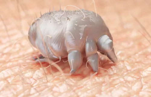 Uyuz ilaçlama Adana